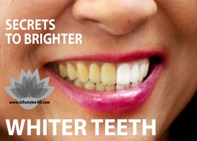 Secrets to brighter whiter teeth